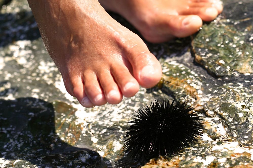 A person about to stand on a sea urchin